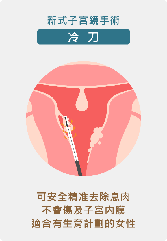 資產-9